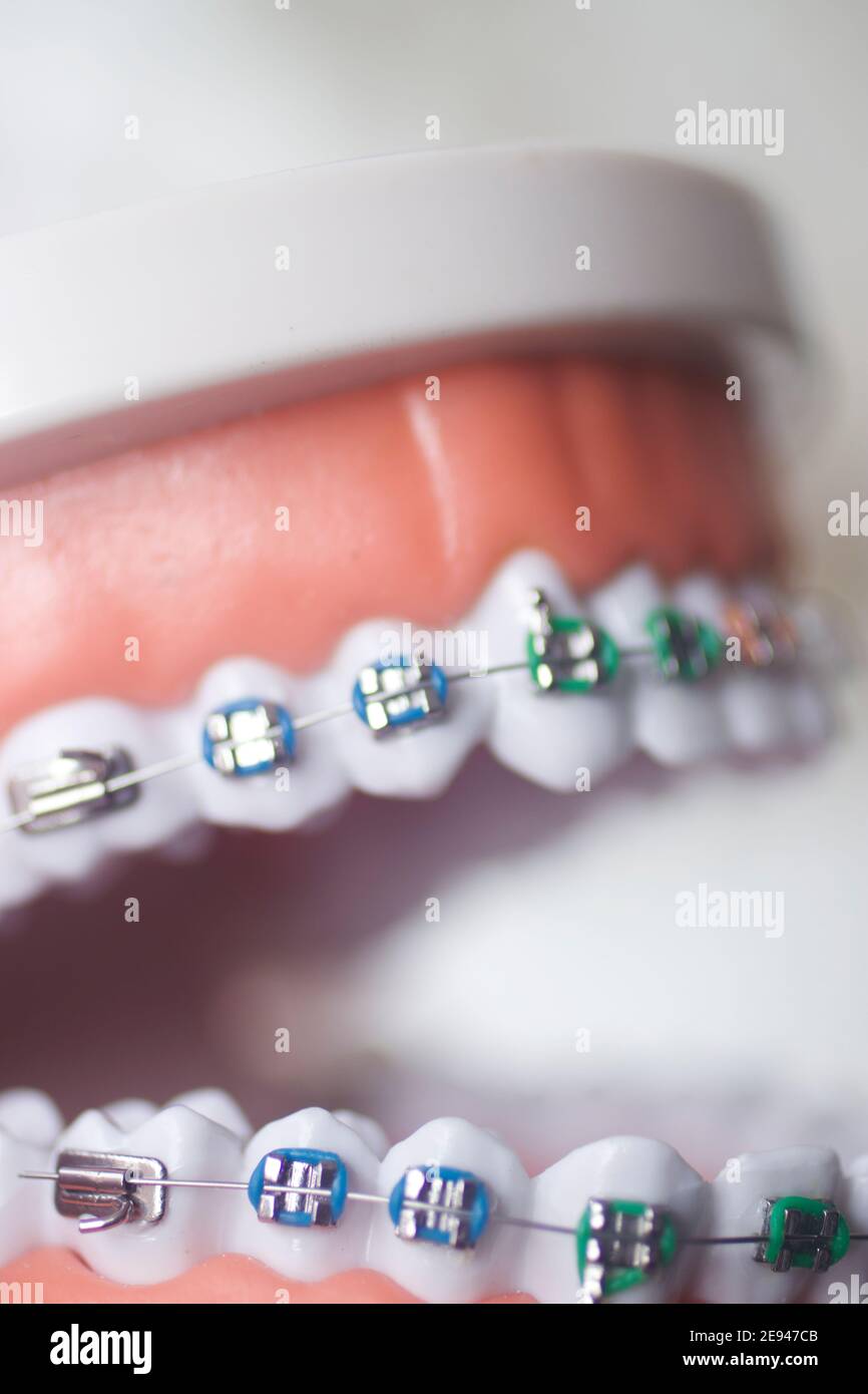 Dental teeth aligner bracket teaching student model showing gums and