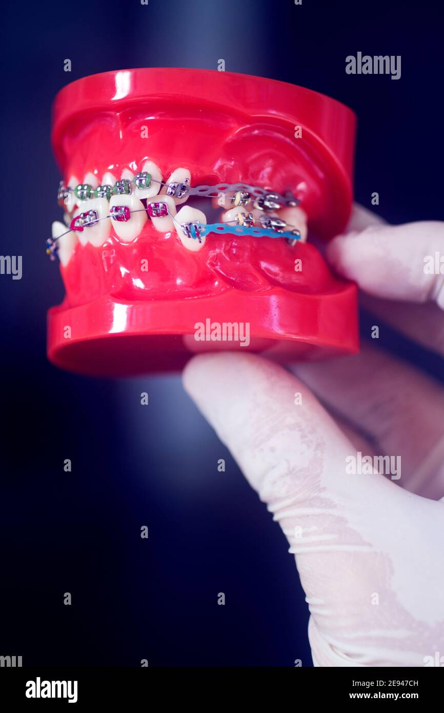 Dental teeth aligner bracket teaching student model showing gums and