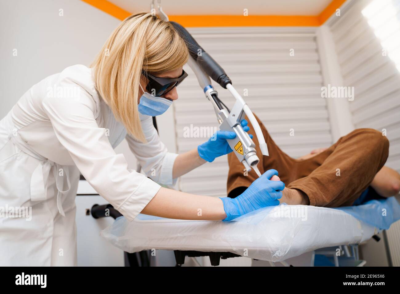 Laser removal of warts on the foot. Medical dermatological surgery in