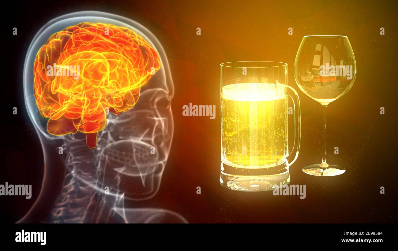 brain affected by vodka and alcohol, cg medicine 3d illustration Stock