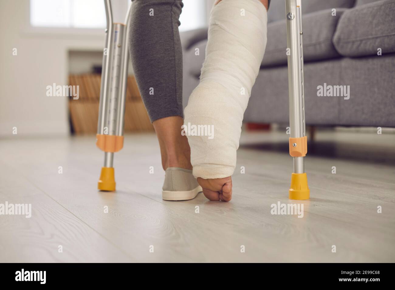Close up of a woman's leg with a broken leg in a cast walking with crutches  in the living room Stock Photo - Alamy, image size:1300x956