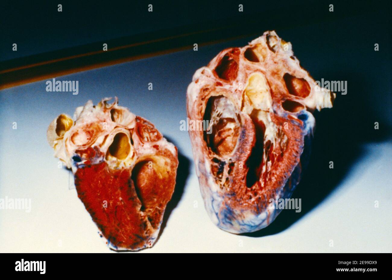 Heart Cut in Half showing Arteries Stock Photo