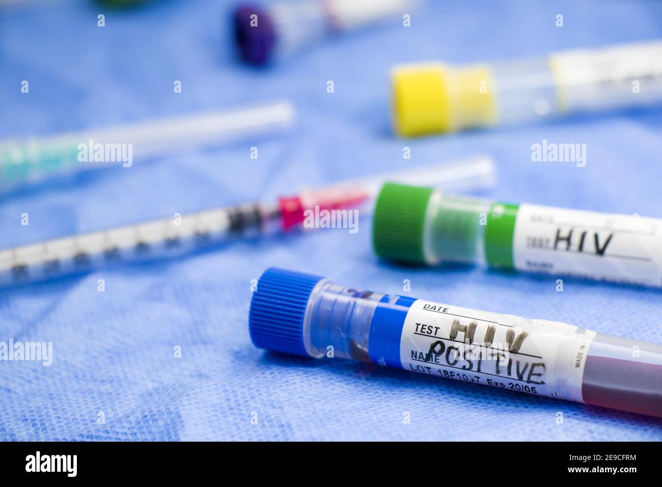 Closeup of HIV POSITIVE test tubes on the table in a laboratory Stock