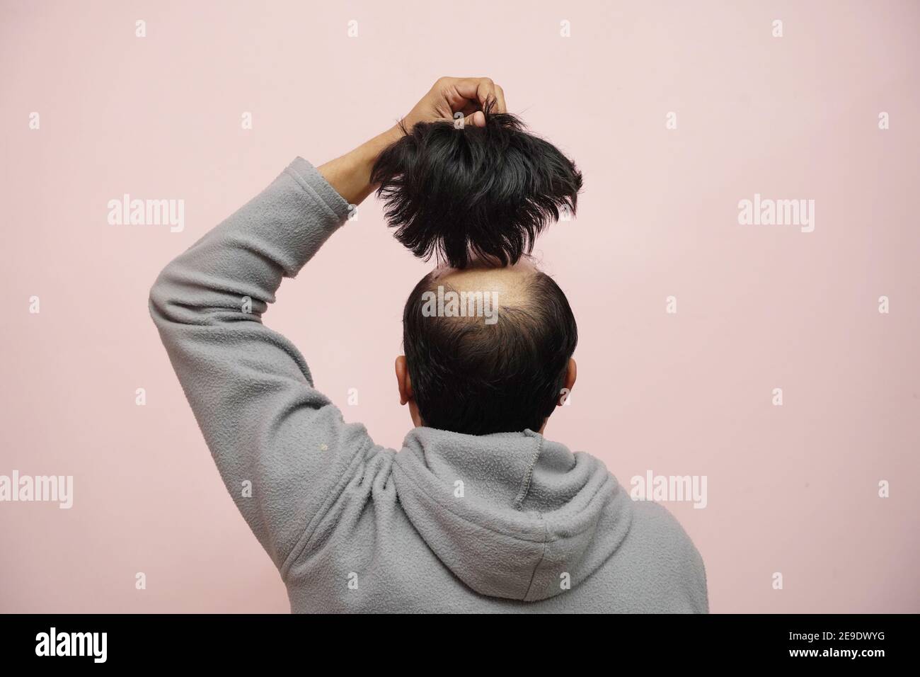 Closeup of a half-bald male removing his wig while wearing a hoodie with a pink background Stock Photo