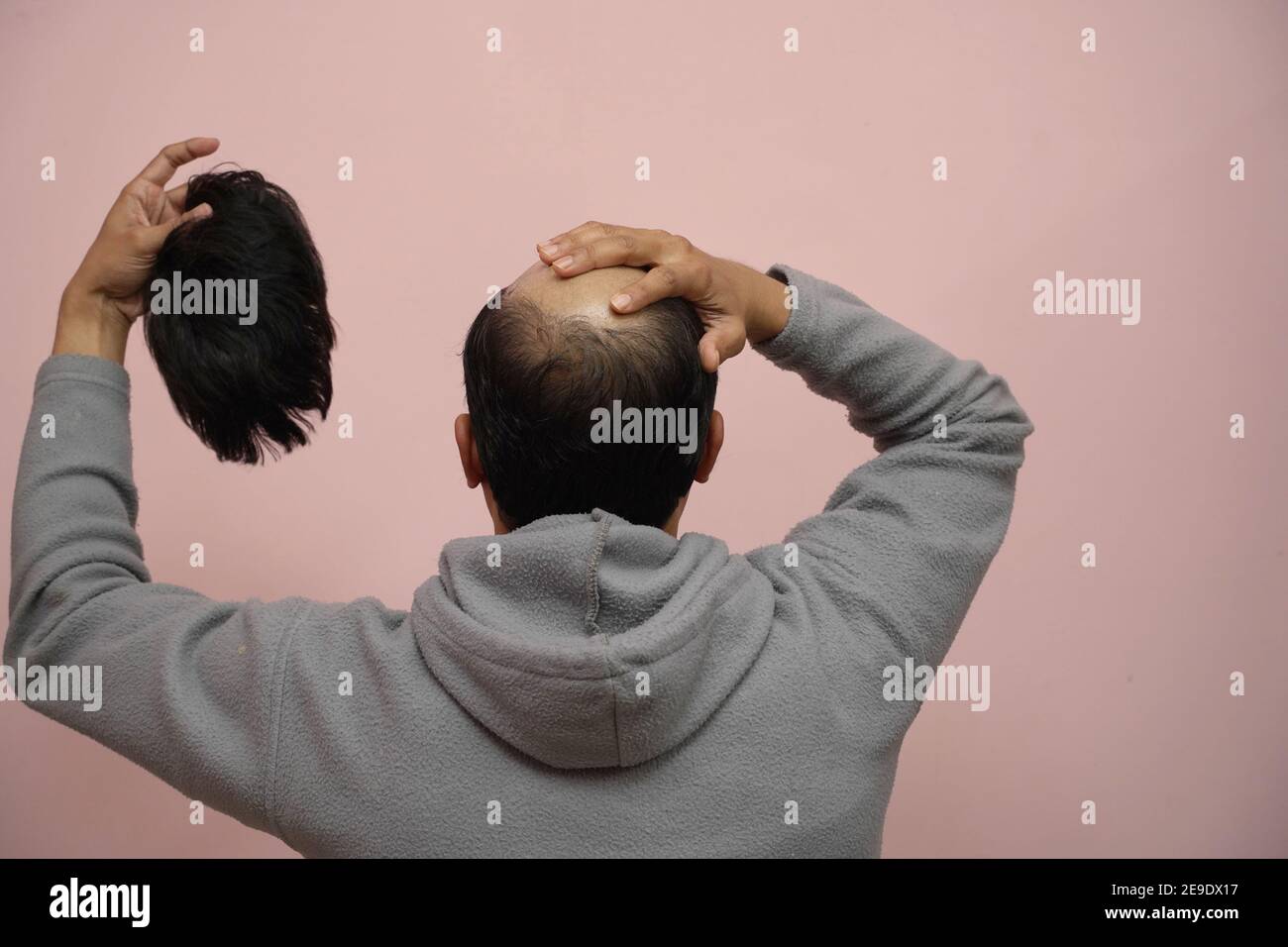 Closeup of a half-bald male removing his wig while wearing a hoodie with a pink background Stock Photo