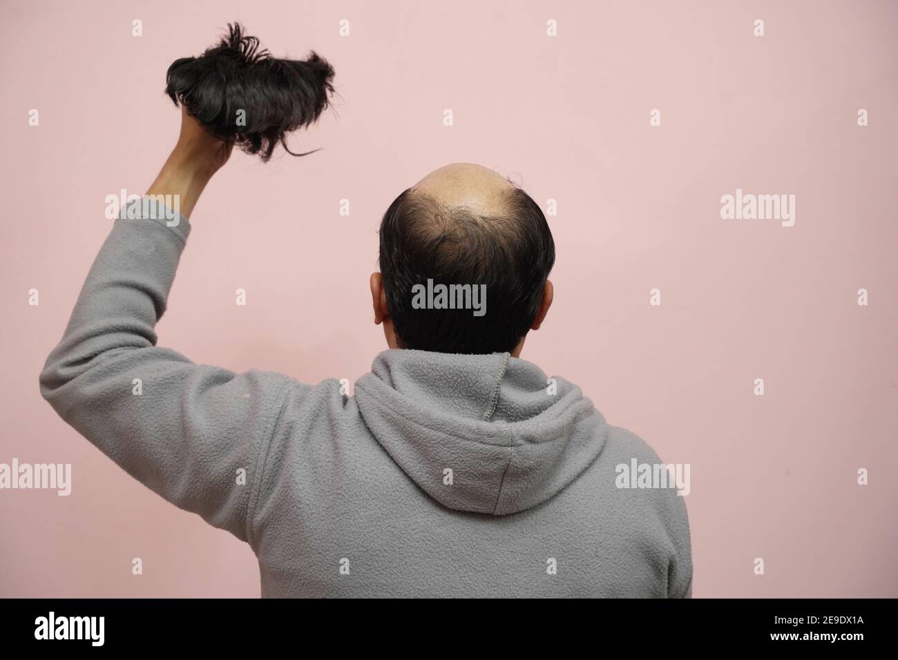 Closeup of a half-bald male holding his wig while wearing a hoodie with a pink background Stock Photo
