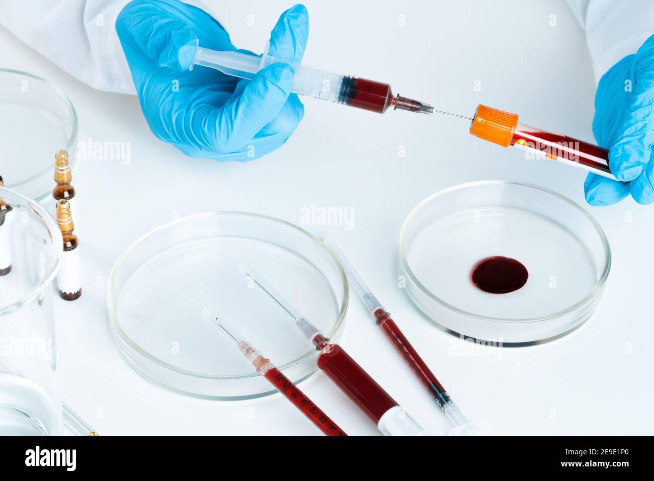 Doctor in blue gloves keep in hands test tube with a blood and syringe Stock Photo