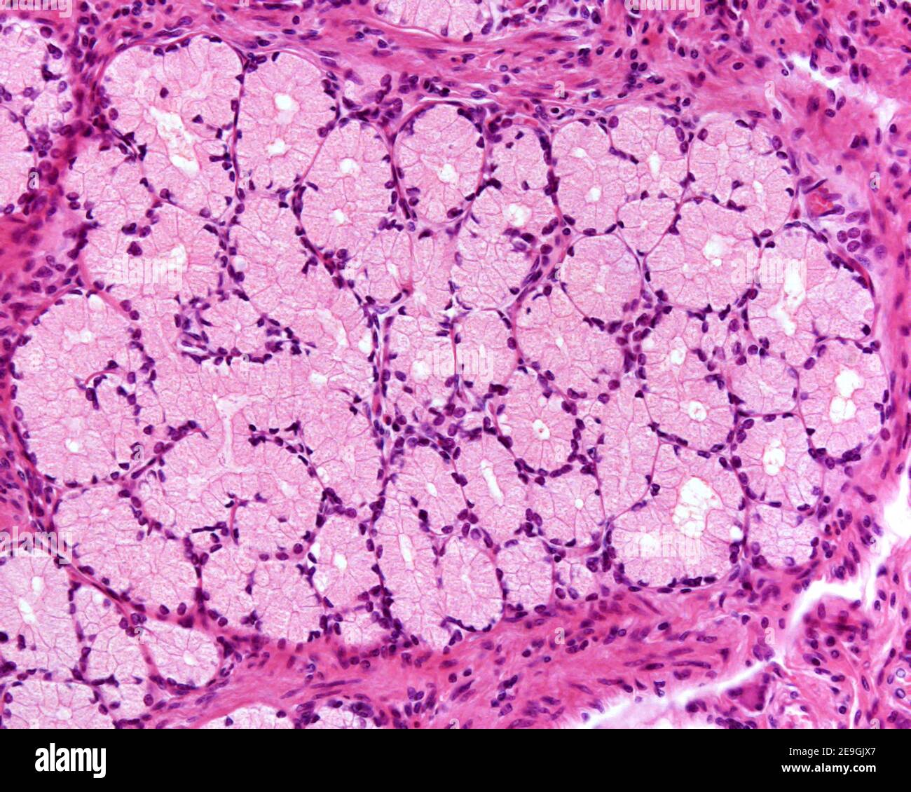 Duodenal Brunner’s glands. They are mucous secreting glands located in