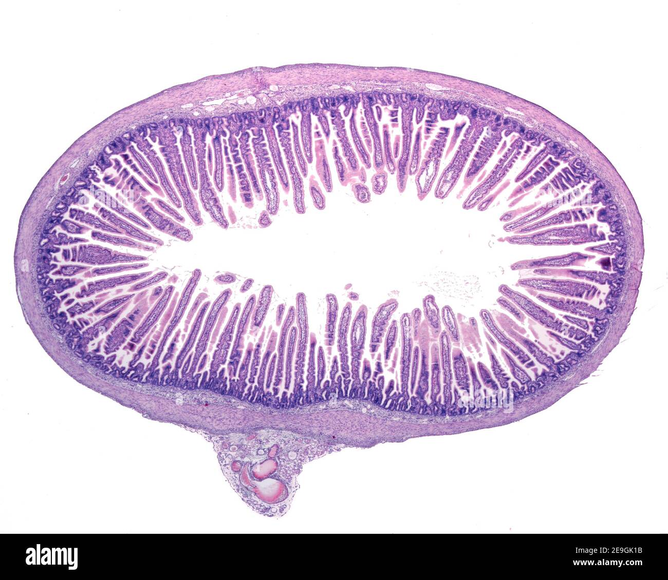 Cross section of a small intestine. The most prominent feature of the mucosal layer is the abundance of villi extending into the lumen. Stock Photo