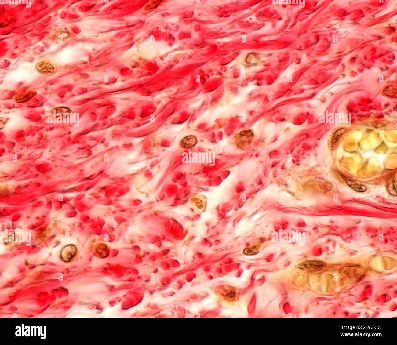 Numerous bundles of collagen fibres selectively stained in red. Submucosa layer of the esophagus, Van Gieson method. Stock Photo
