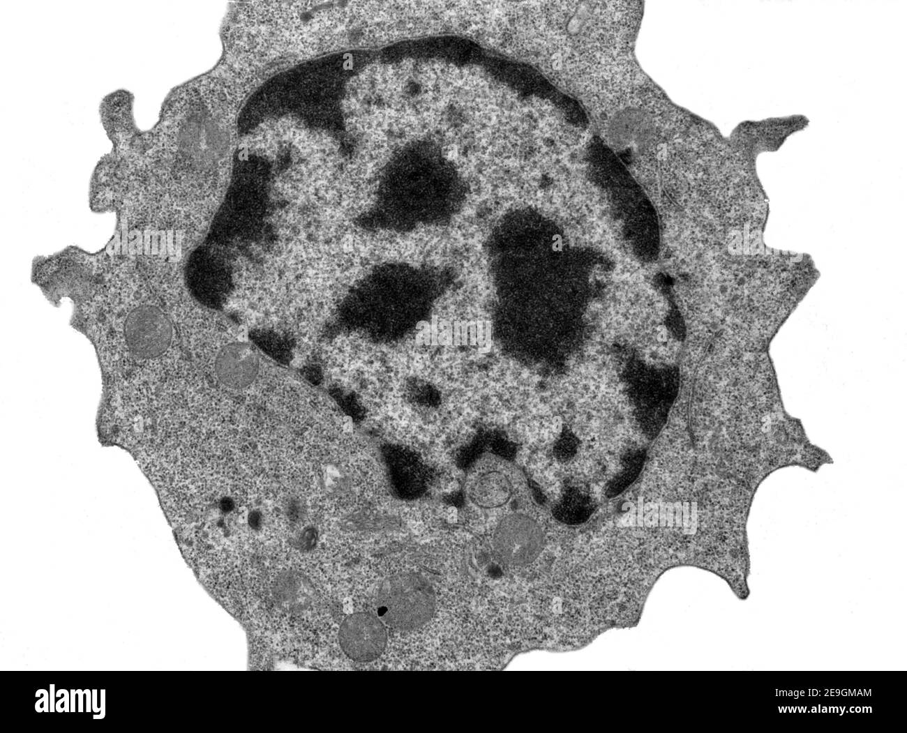 Transmission electron microscope (TEM) micrograph showing a medium-sized lymphocyte with small pseudopodia. The cytoplasm contains many free ribosomes Stock Photo