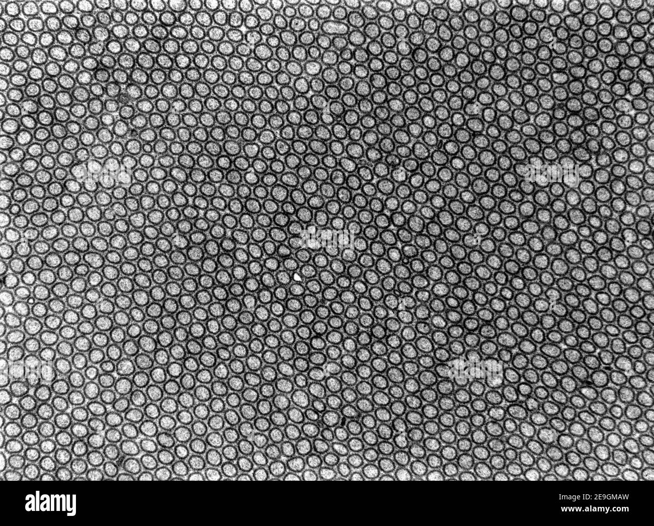 Transmission electron microscope (TEM) micrograph showing a brush (or striated) border in cross section. The microvilli of this small intestine cell a Stock Photo