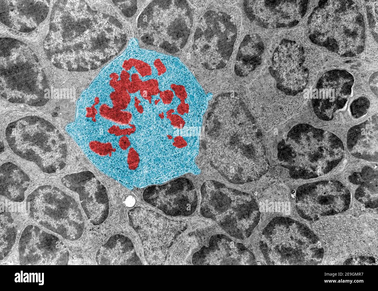 False colour transmission electron microscope (TEM) micrograph of a mitotic cell (blue) surrounded by interphase cells. The chromosomes (red) appear a Stock Photo