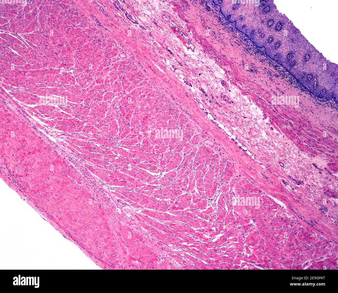 Layers of the wall of a human esophagus: mucosa (with epithelium, lamina propria, and muscularis mucosae), submucosa, muscular (inner and outer layers Stock Photo