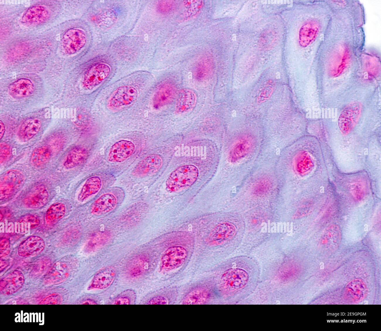 High magnification micrograph of non-keratinized squamous stratified epithelium of the esophagus showing desmosomes between the cells of the stratum s Stock Photo