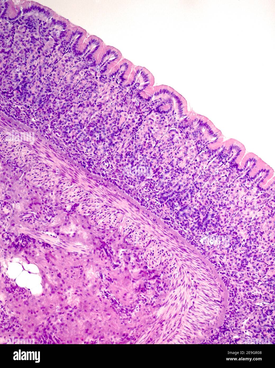 The mucosa layer shows surface mucous epithelium, gastric pits, fundic