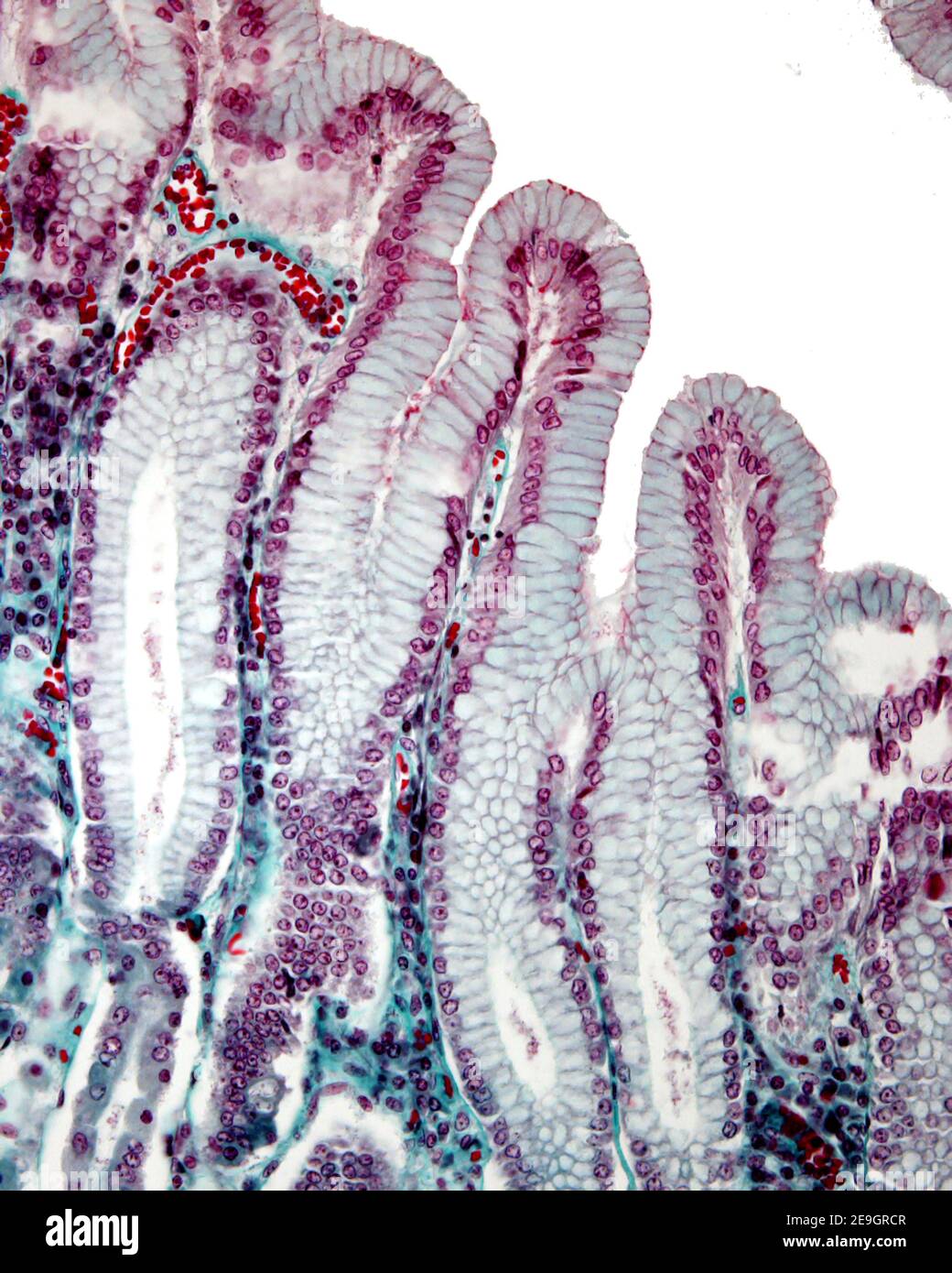 Gastric mucosa stained with the Masson trichrome stain. The surface simple columnar epithelium of the stomach invaginates to form the gastric pits Stock Photo