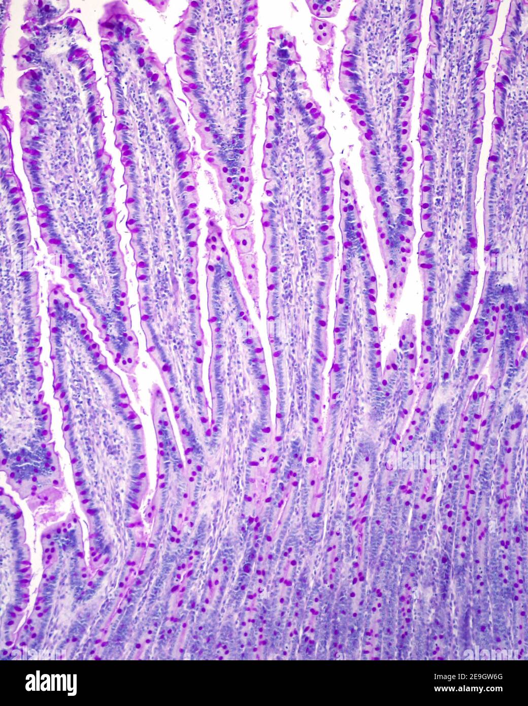 Mucosa of the small intestine showing the goblet cells of the lining epithelium of villi and crypts, stained with the Periodic Acid Schiff (PAS) stain Stock Photo