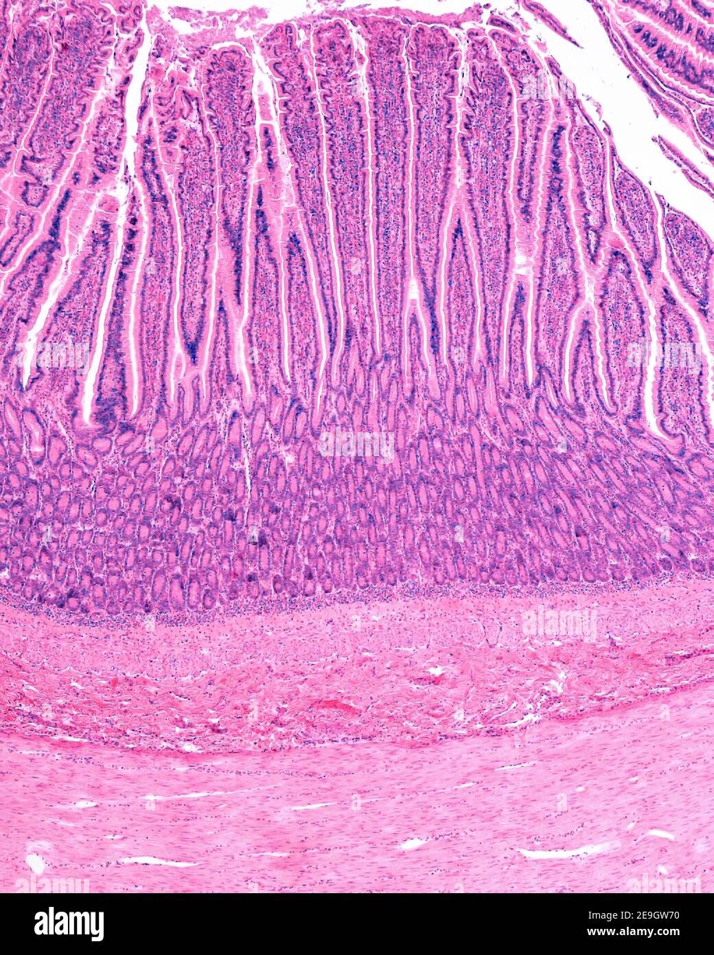 Small Intestine Histology Slides