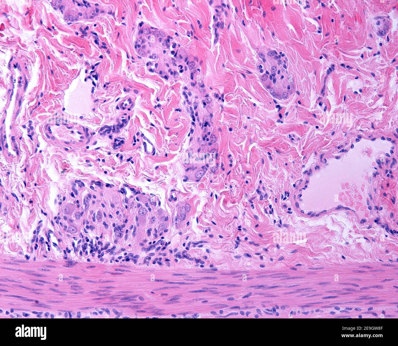 Meissner plexus in the submucosa of the digestive tract showing several ganglia containing