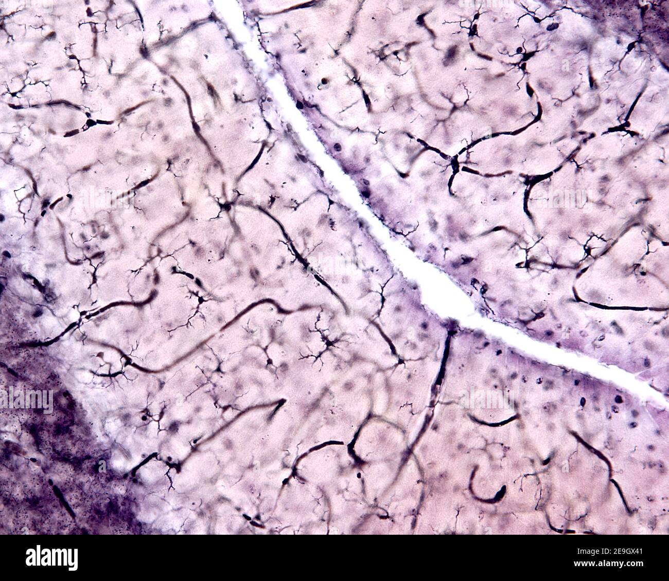 Microglia in the molecular layer of the cerebellar cortex. The thick dark lines, often curved, are blood capillaries. Rio Hortega's Silver carbonate Stock Photo