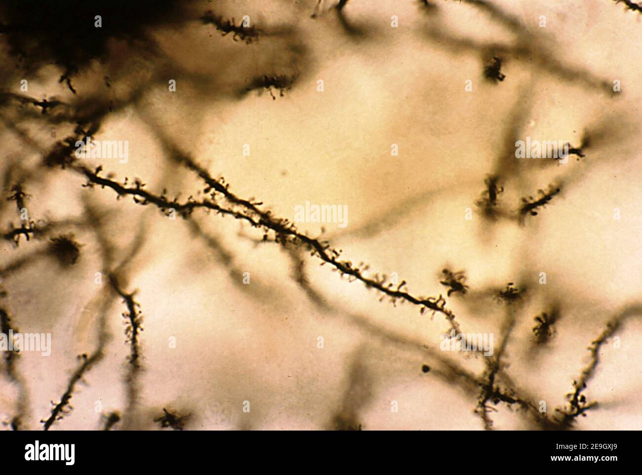 Dendrites of pyramidal cells of the cerebral cortex stained with the Golgi’s silver chromate. The dendrites have numerous spines on their surface. Stock Photo