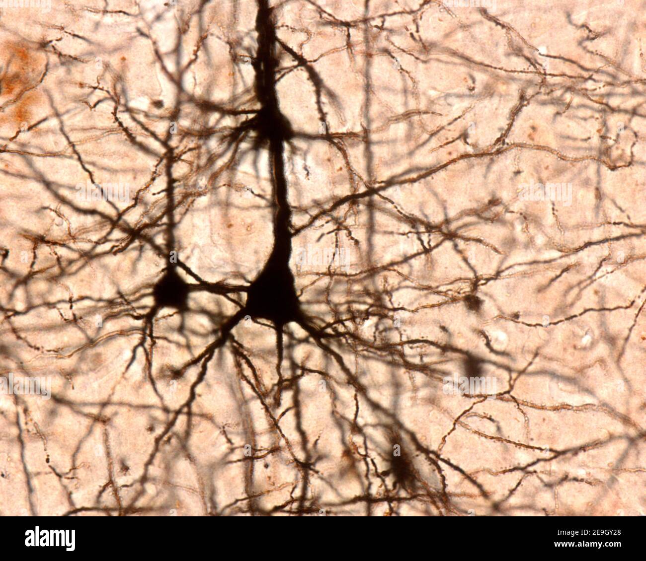 Pyramidal neurons of the cerebral cortex. Golgi’s silver chromate. From the conic shaped soma, a large apical dendrite and multiple basilar dendrites Stock Photo