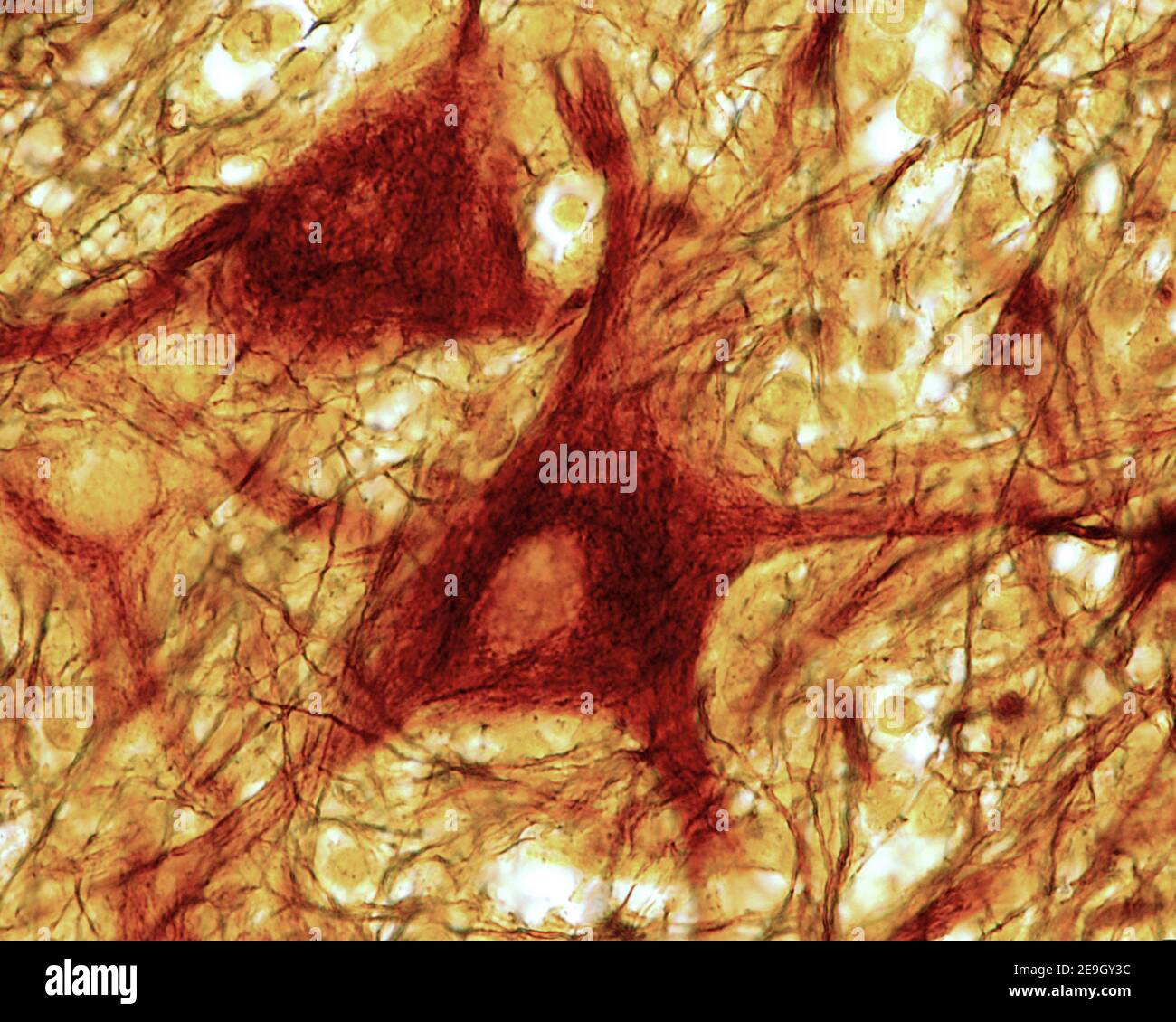 Multipolar neuron of the anterior horn of the spinal cord showing the meshwork of neurofibrils present in the soma and dendrites. Cajal's silver nitra Stock Photo