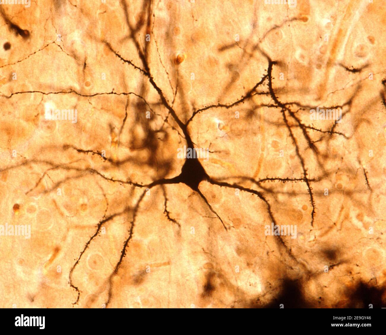 Pyramidal neuron. Golgi’s silver chromate. The apical dendritic trunk and the basilar dendrites contain  many spines. From the bottom arises the axon Stock Photo