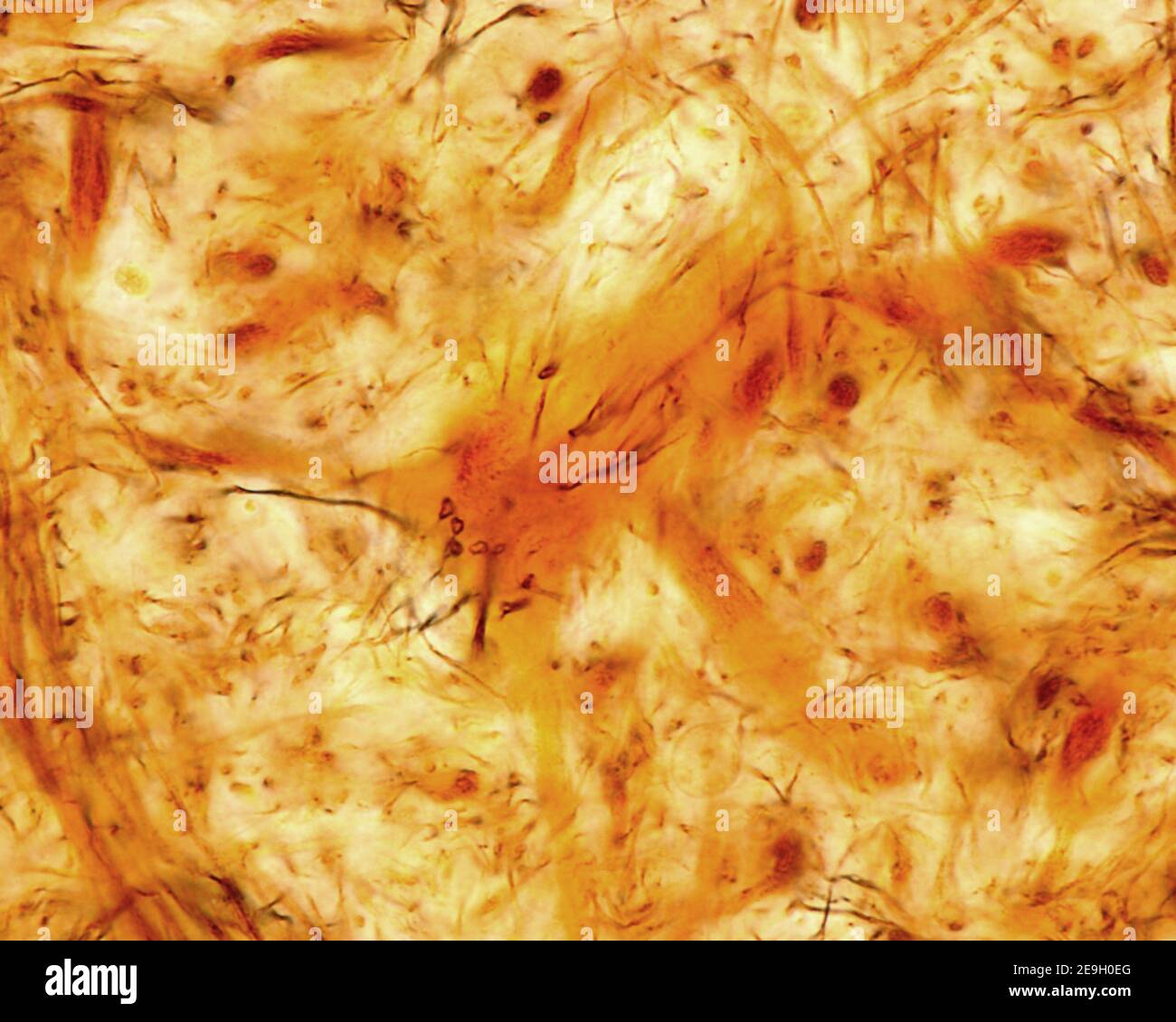 Tangential section of a neuronal soma showing synaptic terminals, both in the form of boutons and neurofibrillary rings. Cajal’s silver nitratrate Stock Photo