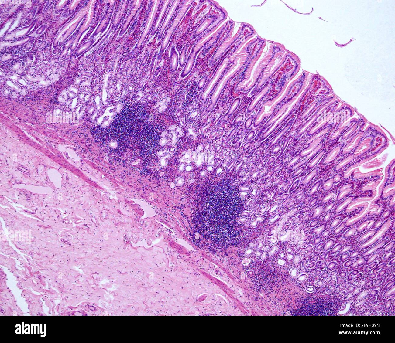 Stomach. Pyloric antrum showing: the great depth of the gastric crypts, the presence of pyloric glands and lymphoid follicles Stock Photo