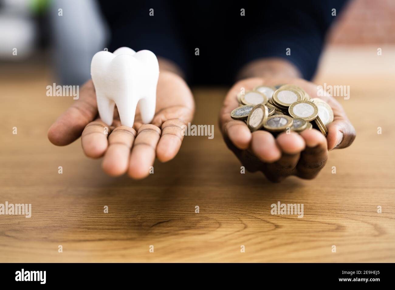 Dental Tooth Implant Cost. Teeth Insurance Money Stock Photo Alamy