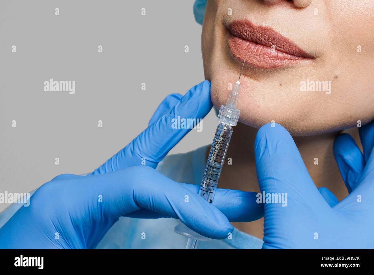 Closeup lips augmentation injections for attractive girl on white ...