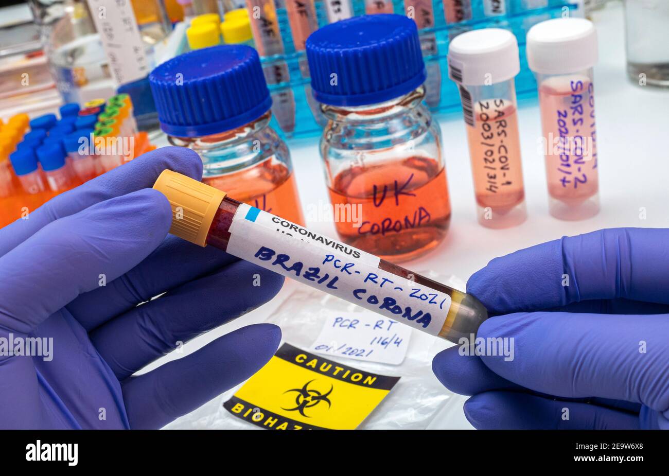 Scientist holds positive blood vial of the new Brazilian strain of covid-19 in research, conceptual image Stock Photo