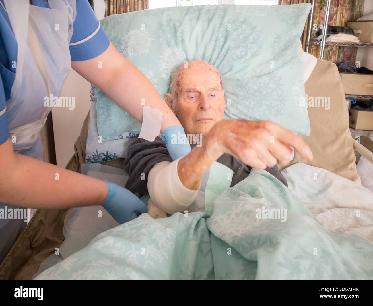 The ninety five year old has the injured arm bandaged at his house by a visiting district nurse.He is unable to leave his bed or house due to frailty Stock Photo