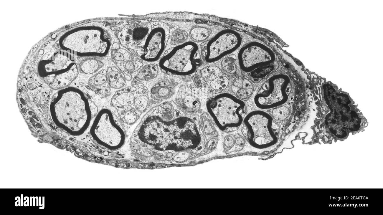 Peripheral nerve, TEM Stock Photo