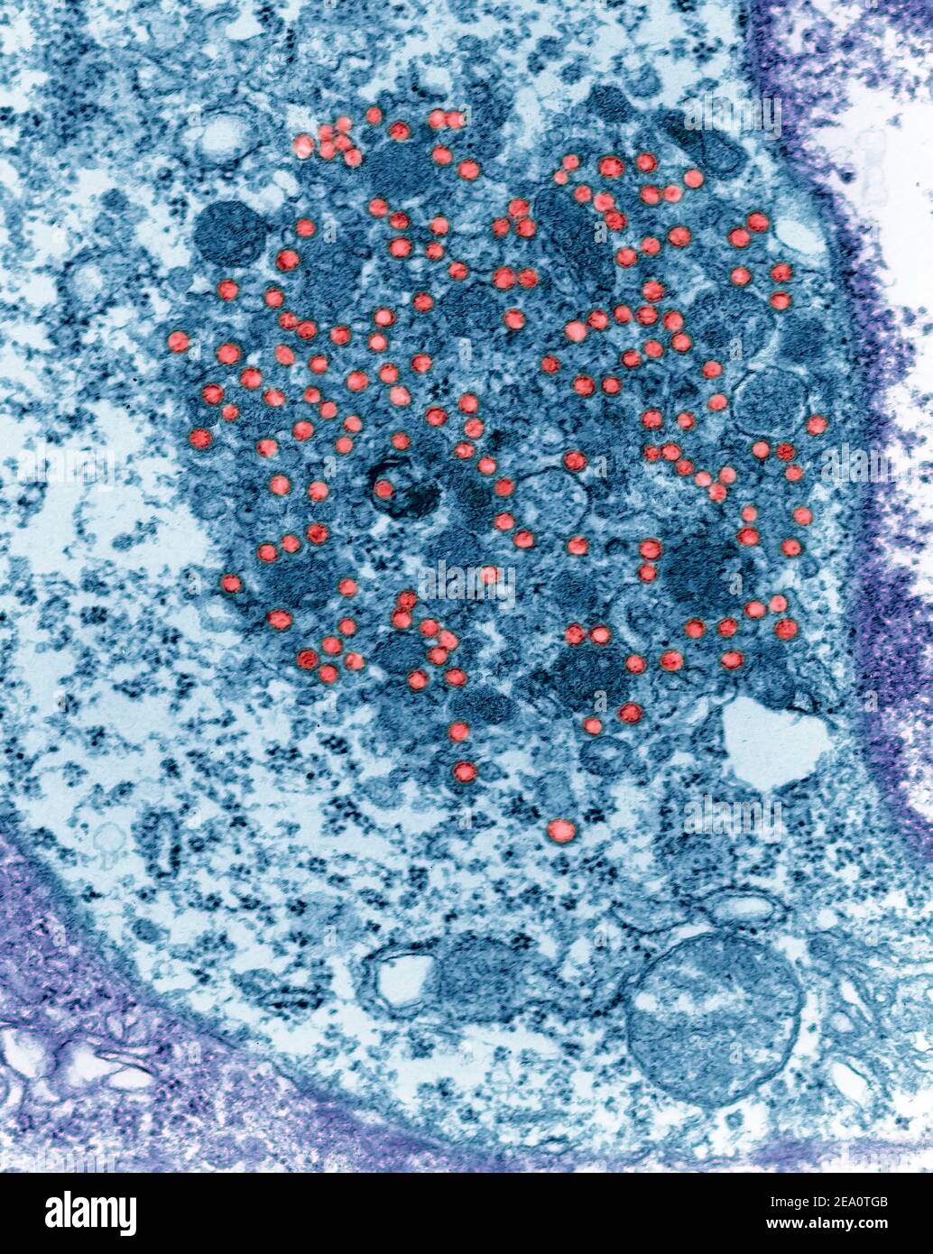 Mouse mammary tumour virus, TEM Stock Photo