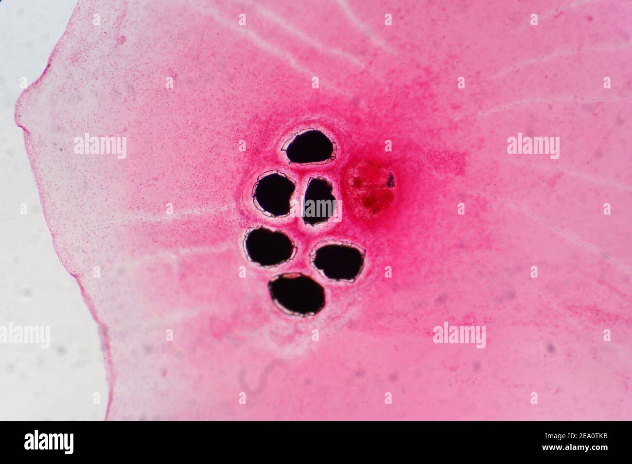 Liver fluke eggs hi-res stock photography and images - Alamy