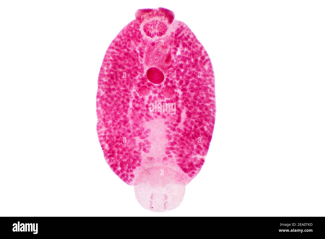 Liver fluke, light micrograph Stock Photo