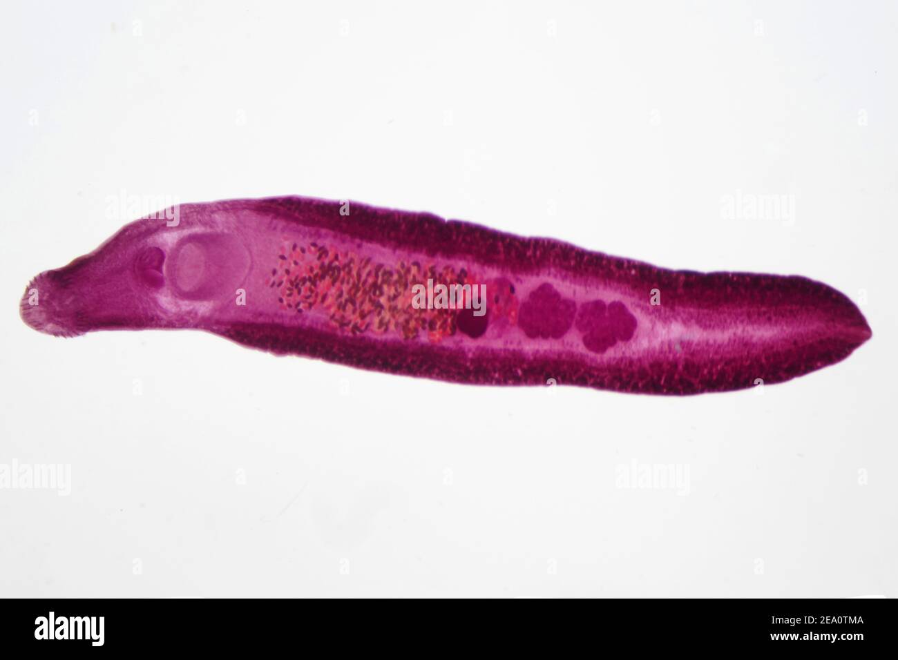 Liver fluke, light micrograph Stock Photo