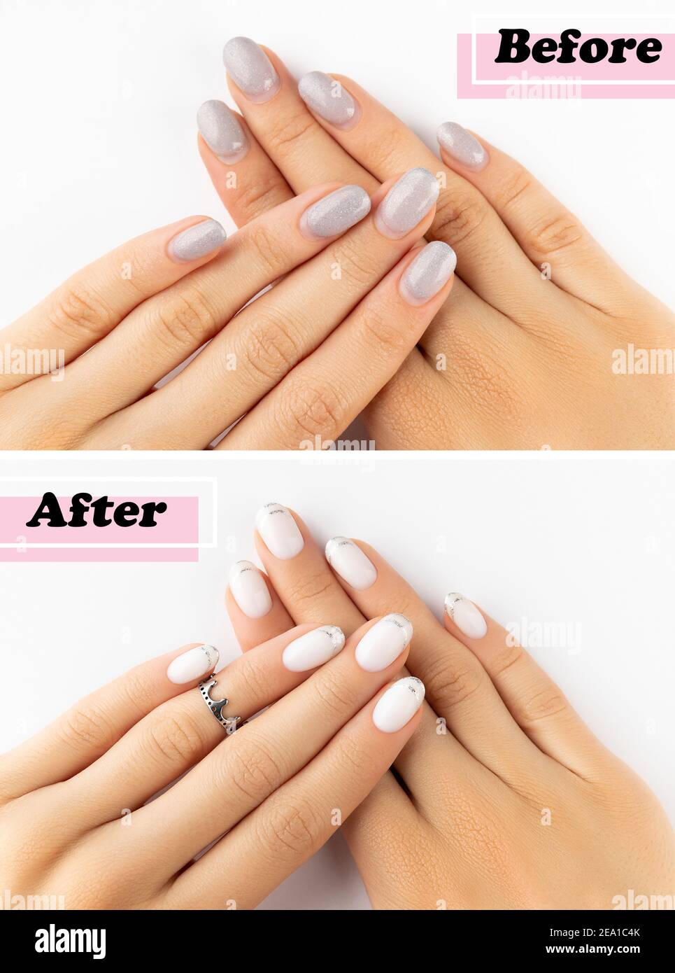 Womans hands before and after manicure correction procedure Stock Photo