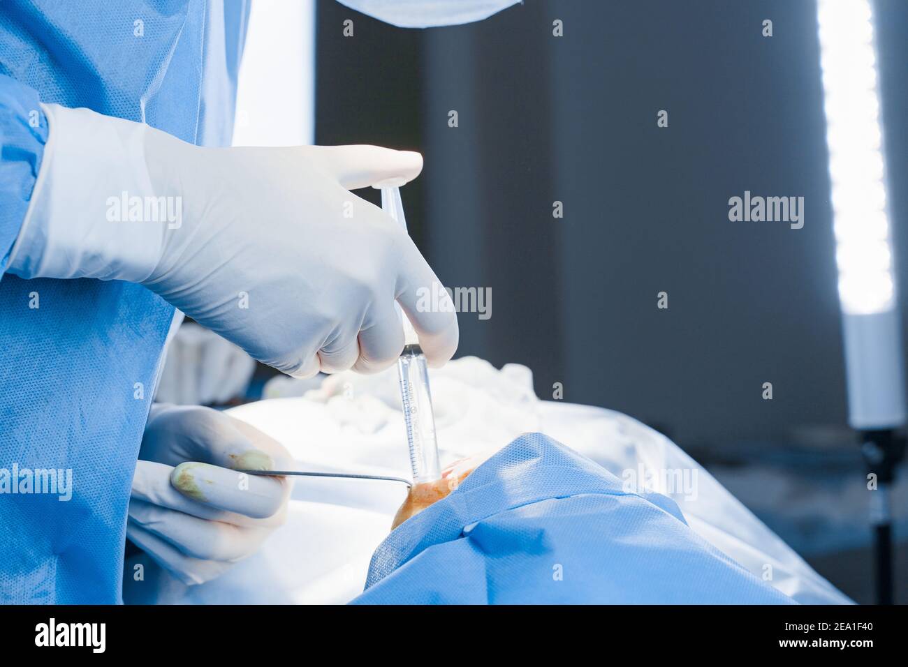 Anesthesia thigh injection before Buccal fat removal. Bisha lumps