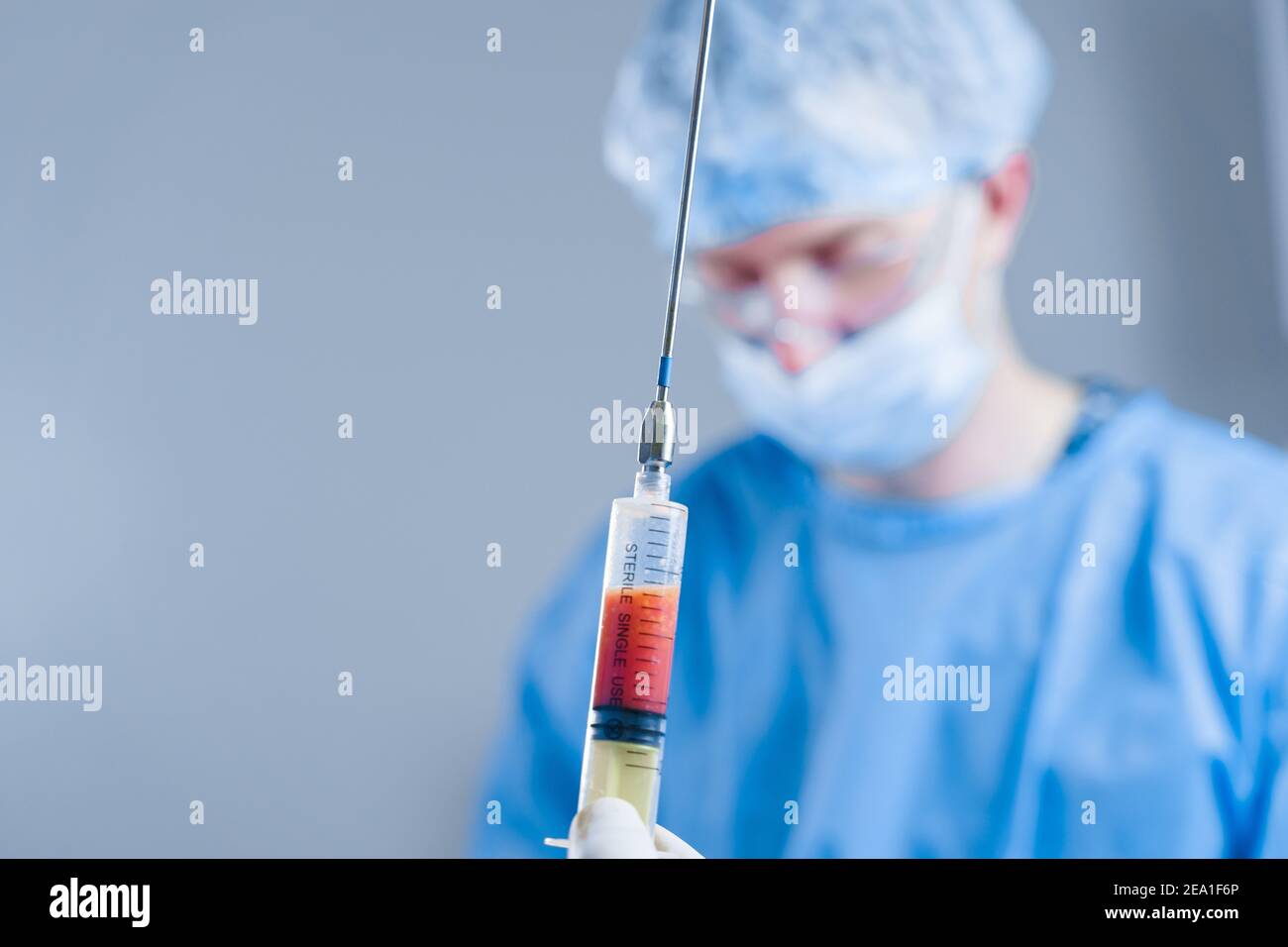 Human fat in a syringe closeup. Liposuction for lipofilling surgery