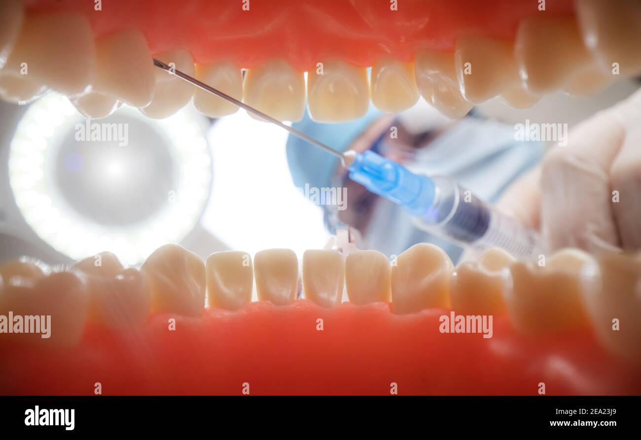Patient at a dentist appointment in a dental clinic. View from inside the dental jaw. Stock Photo