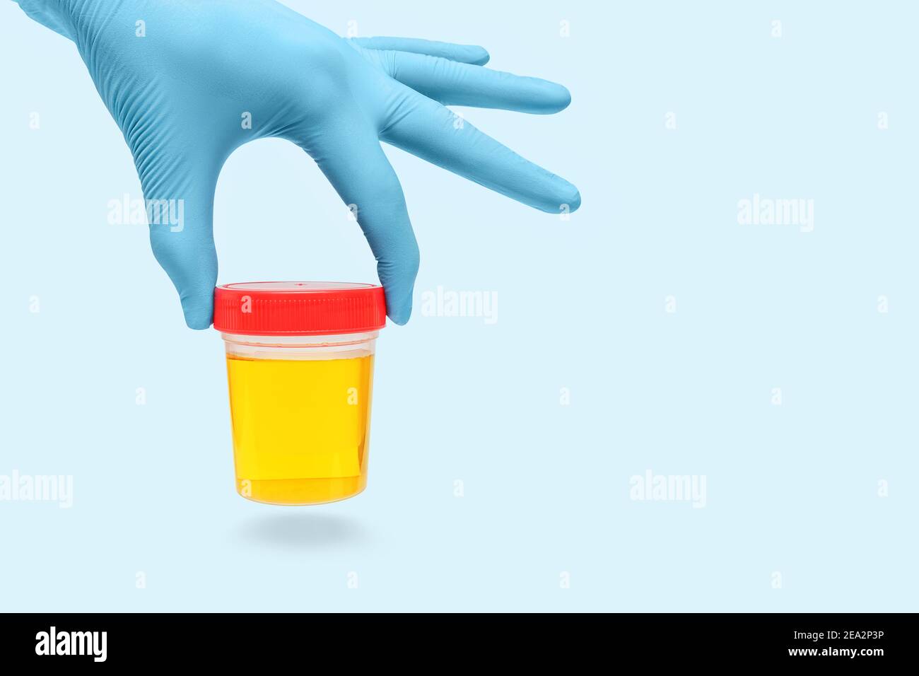 urine sample analysis in a jar in hands gloves by a doctor or a bio lab