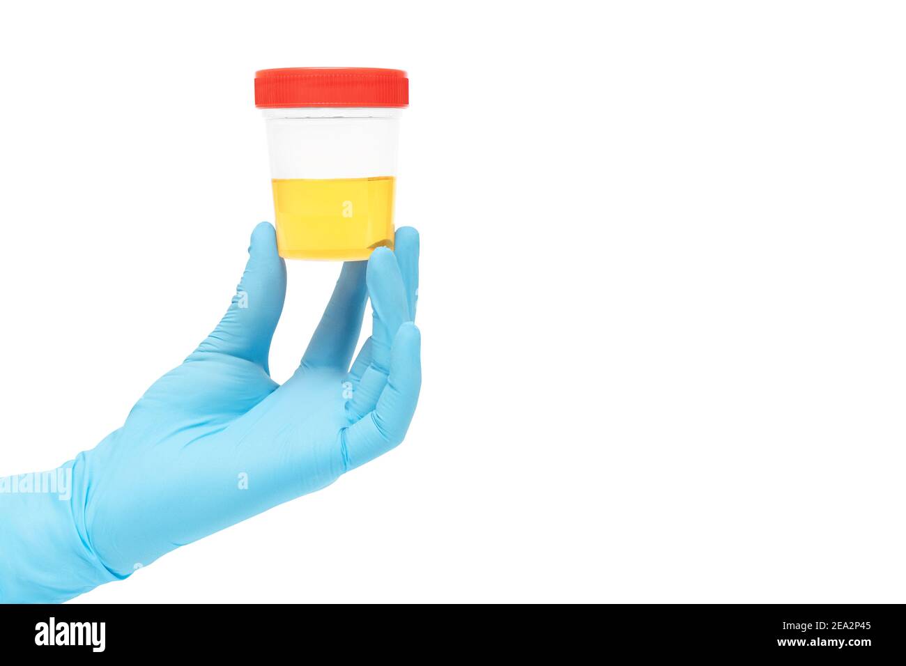 urine sample analysis in a jar in hands gloves by a doctor or a bio lab