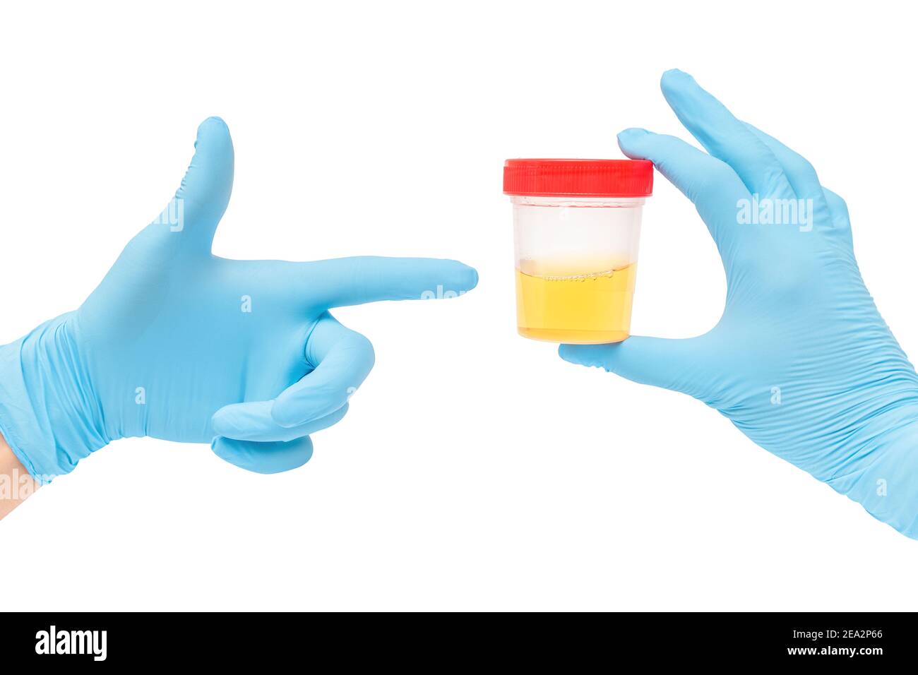 urine sample analysis in a jar in hands gloves by a doctor or a bio lab