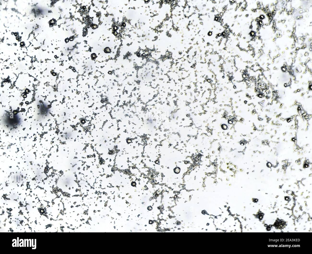 Orange mold spores under the light microscope, uncolored mold sample Stock Photo