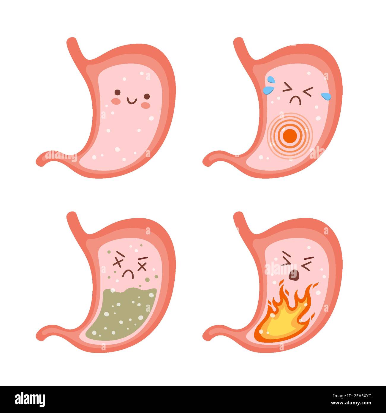 Healthy stomach and sick stomach characters. Gastritis, indigestion
