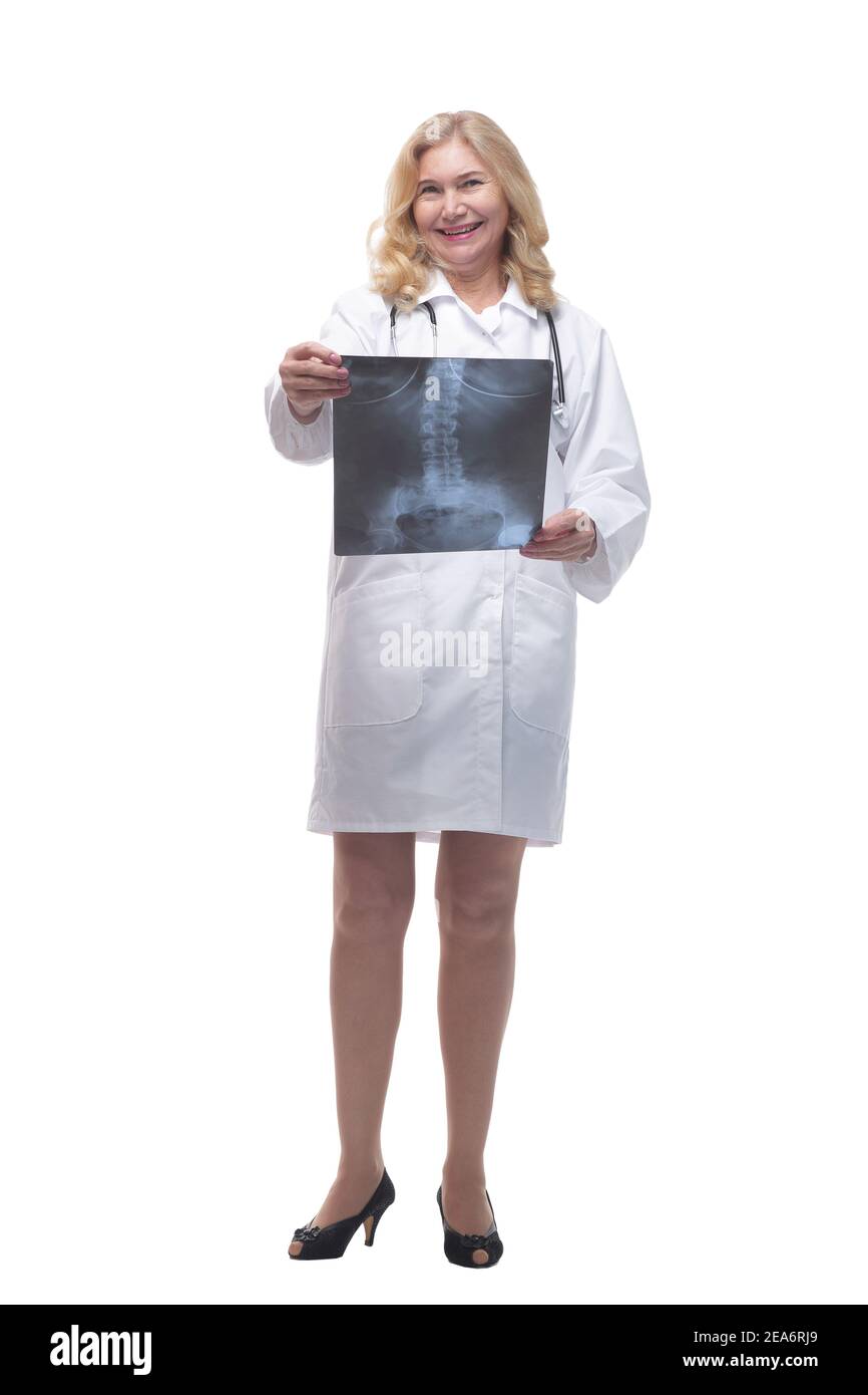 Pneumonia on x ray Cut Out Stock Images & Pictures - Alamy